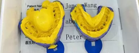 长沙传统取模