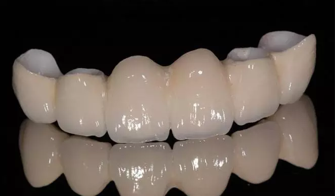 长沙烤瓷牙