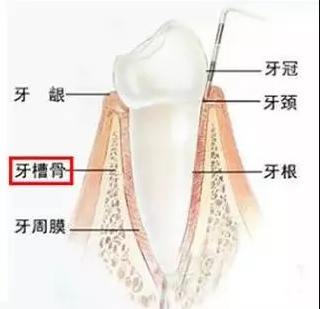 牙齿矫正原理