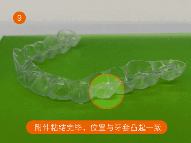 长沙隐形矫正附件