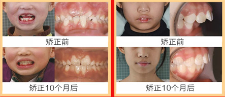 新年(链接页-移动)_20.jpg 新年(链接页-移动)_20.jpg